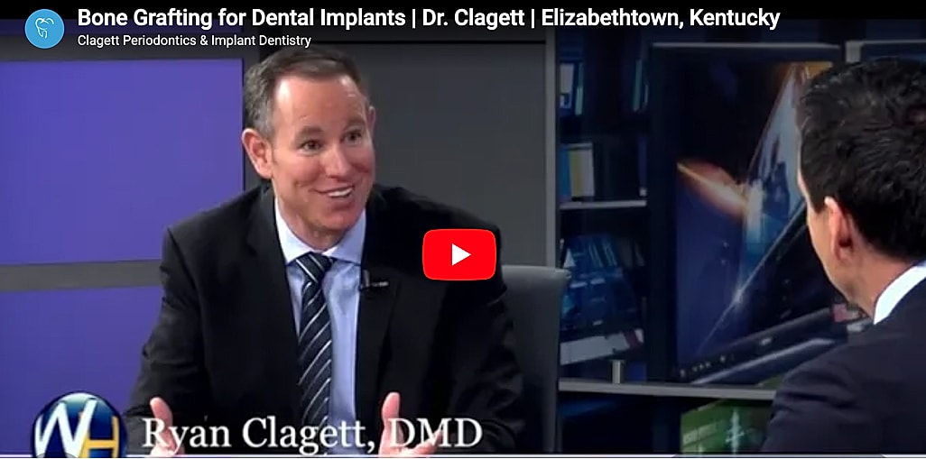 Dr. Clagett discussing bone grafting for dental implants