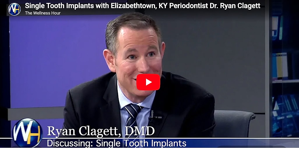 Dr. Ryan Clagett discussing single tooth implants